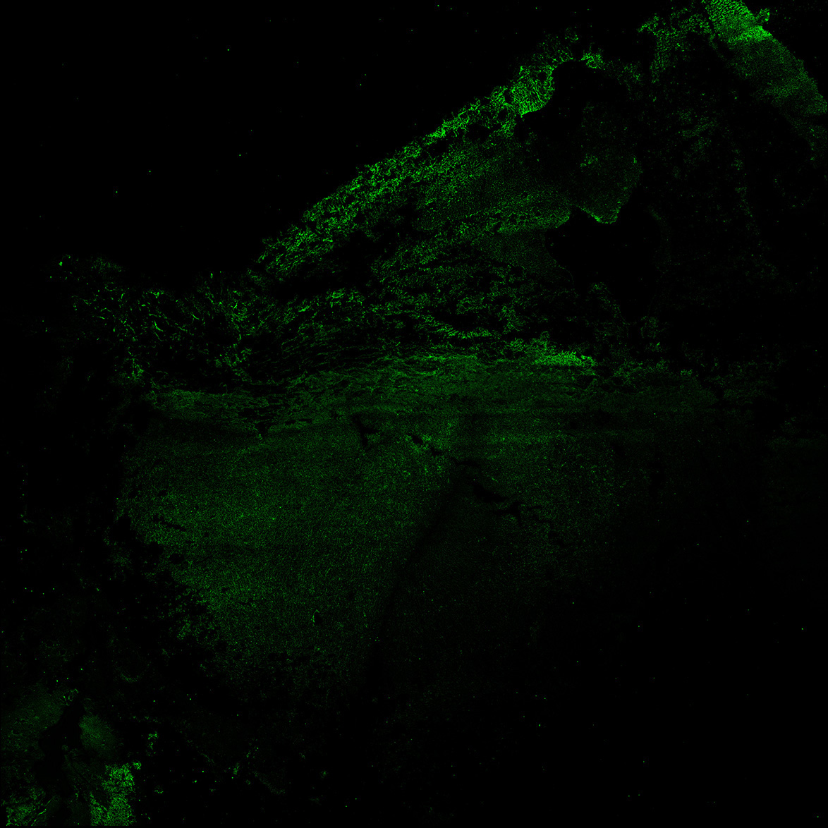 Human foetal midbrain